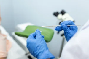 vaginal smear closeup da mao do medico segura instrumentos de exame ginecologico ginecologista trabalhando na clinica de obstetricia e ginecologia