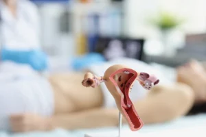 modelo anatomico do utero e ovarios da mulher na ultrassonografia